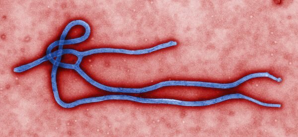 cynthia-goldsmiththis-colorized-transmission-electron-micrograph-tem-revealed-some-of-the-ultrastructural-morphology-displayed-by-an-ebola-virus-virion-see-phil-1832-for-a-black-and-white-version